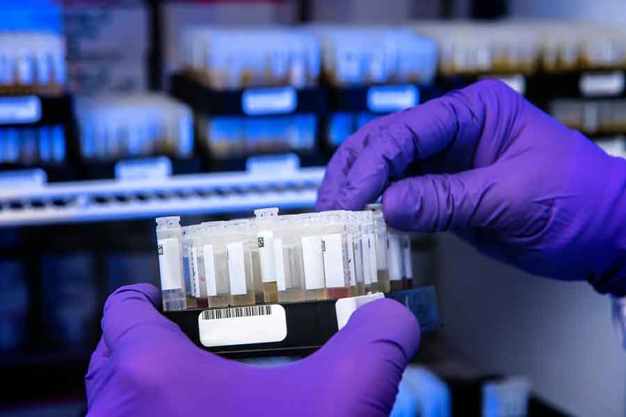 Mayo Clinic Researchers Develop AI-ECG Model to Diagnose Liver Disease Earlier
